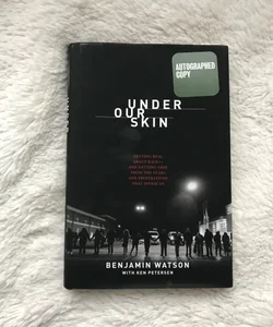 Under Our Skin (signed)