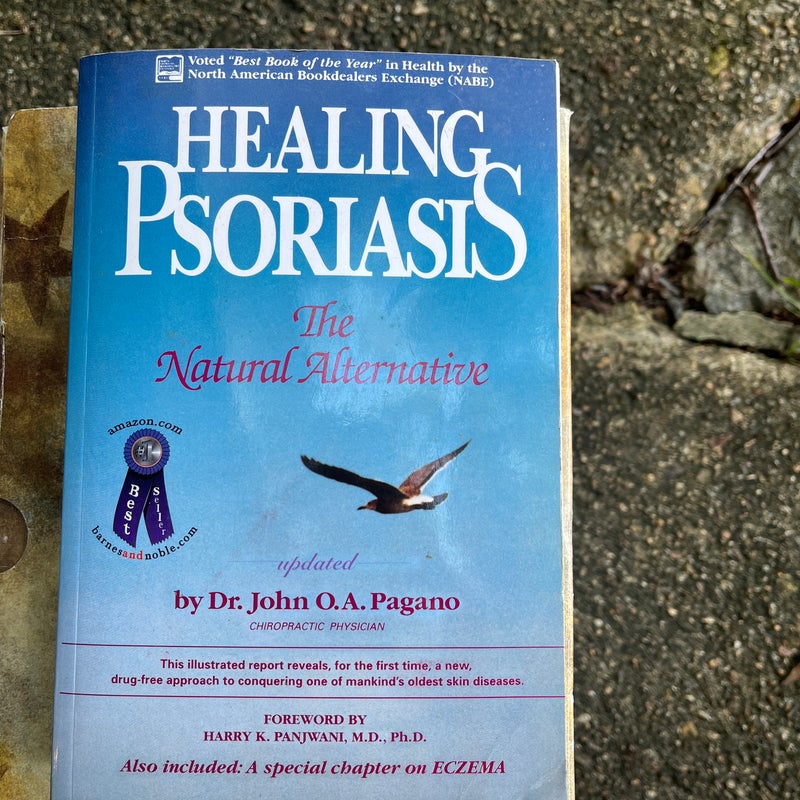 Healing Psoriasis