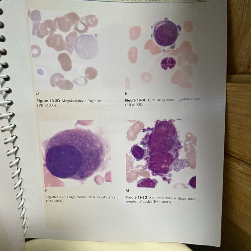 Clinical Hematology Atlas