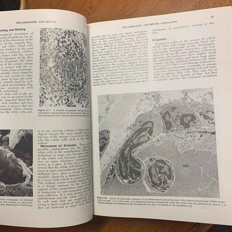 Pathologic Basis of Disease