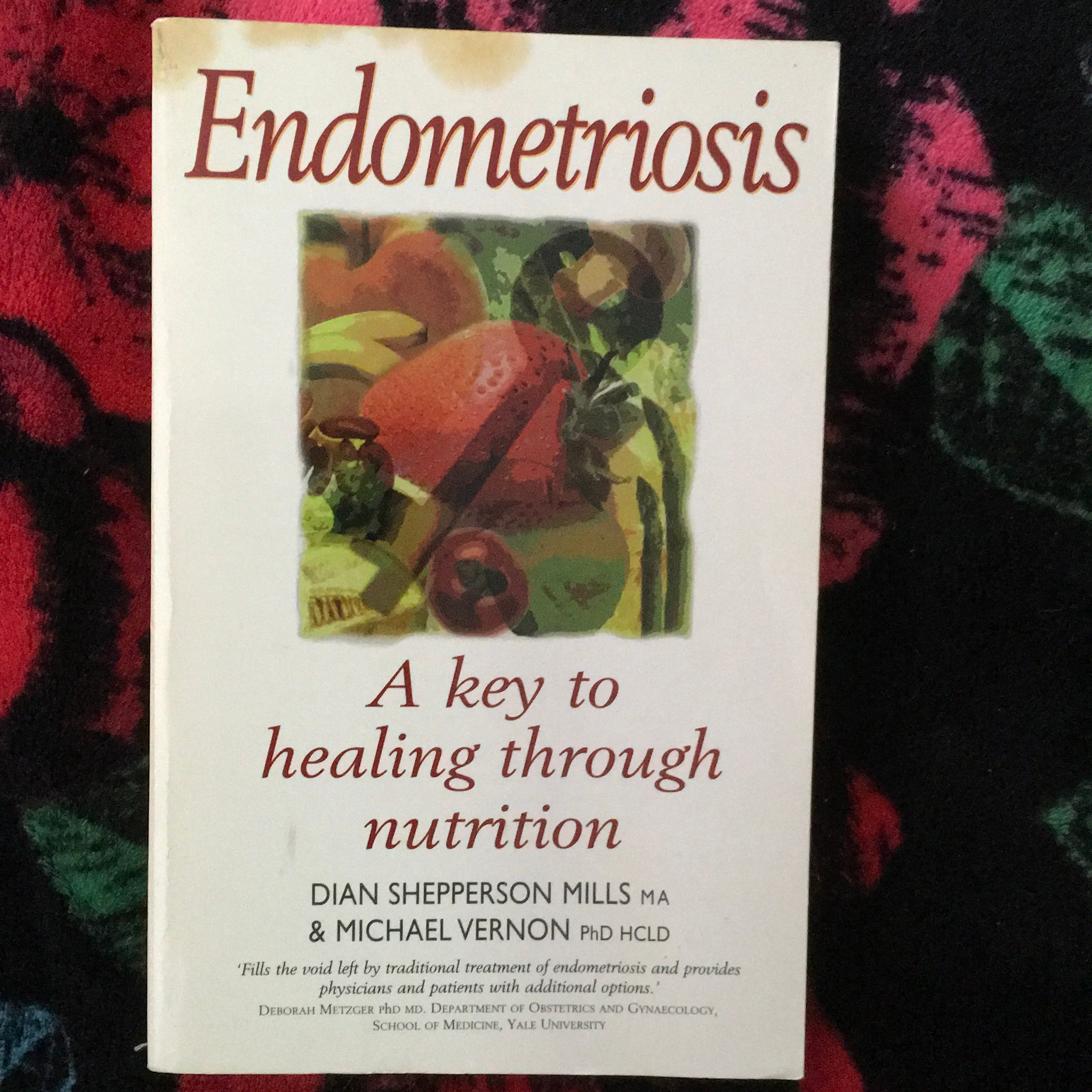 Endometriosis