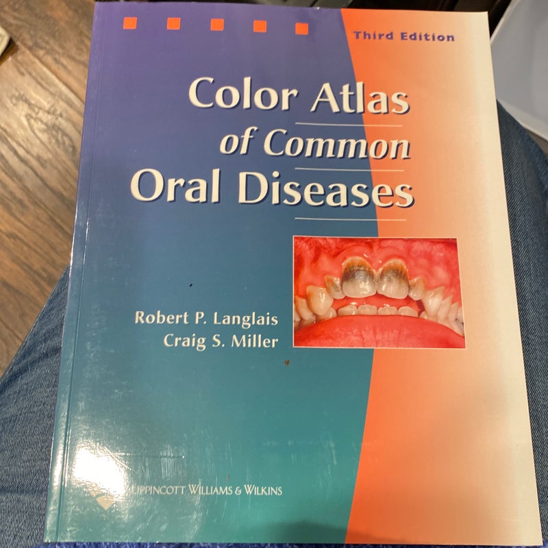 Color Atlas of Common Oral Diseases