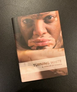 Turning White (signed)