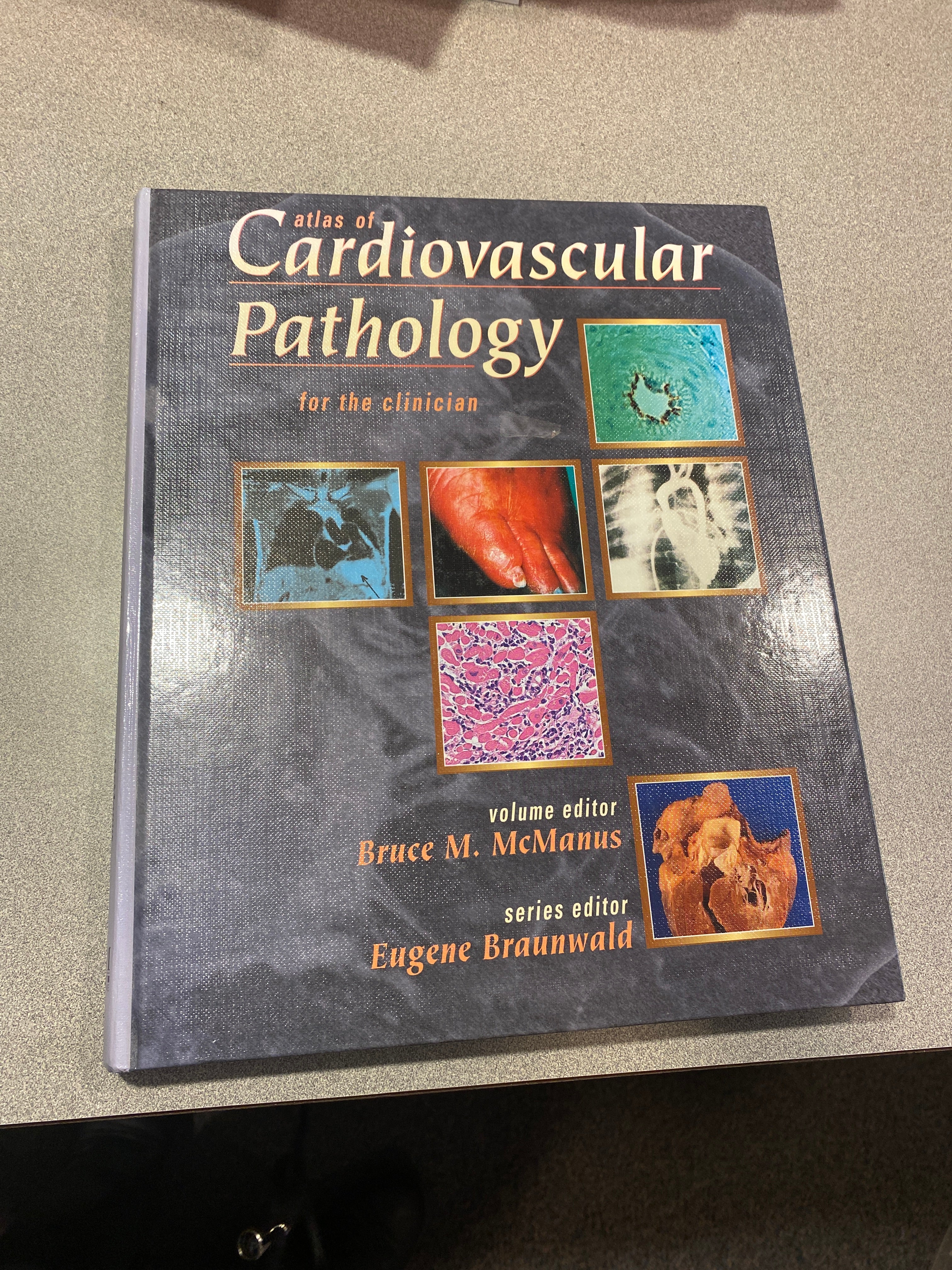 Atlas of Cardiovascular Pathology