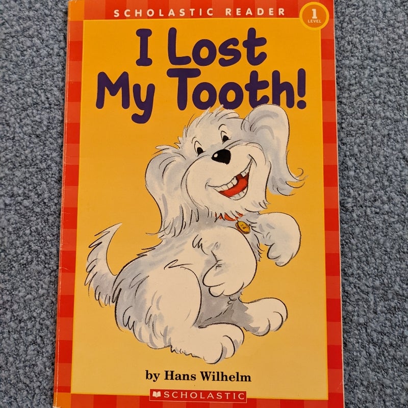 I Lost My Tooth!