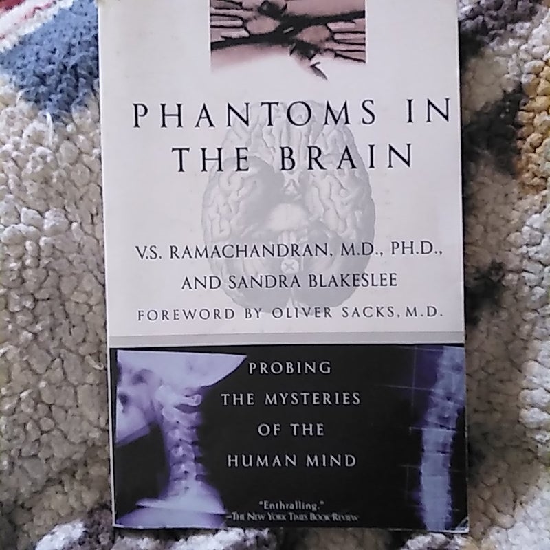 Phantoms in the Brain