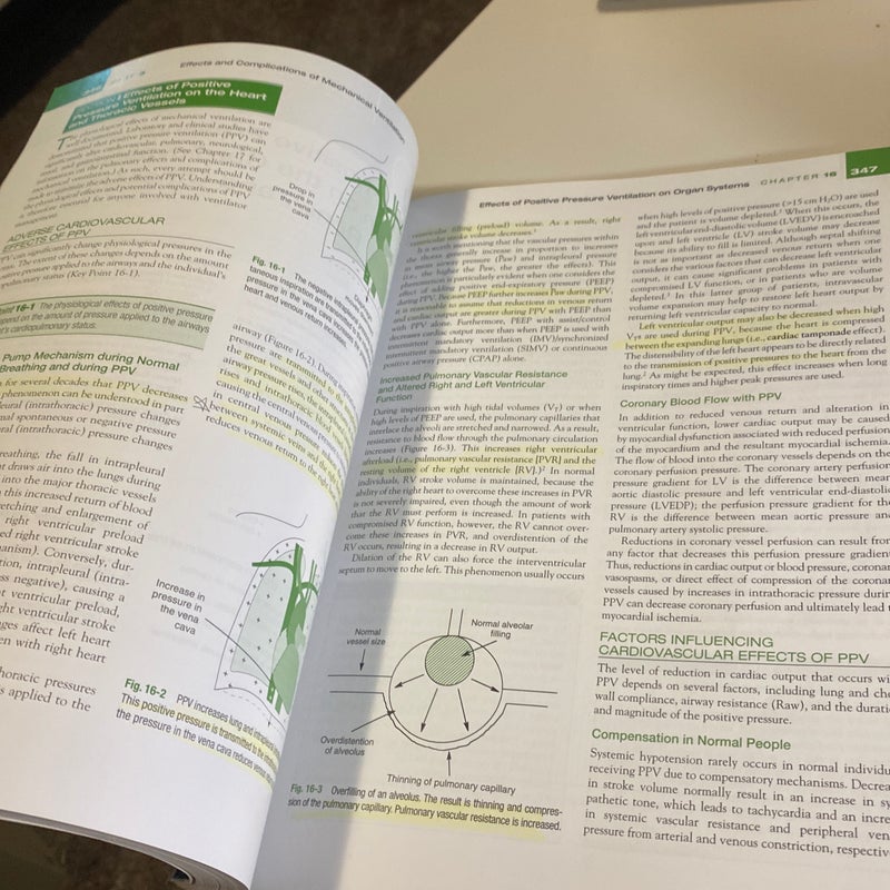 Mechanical Ventilation