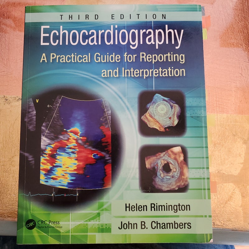 Echocardiography