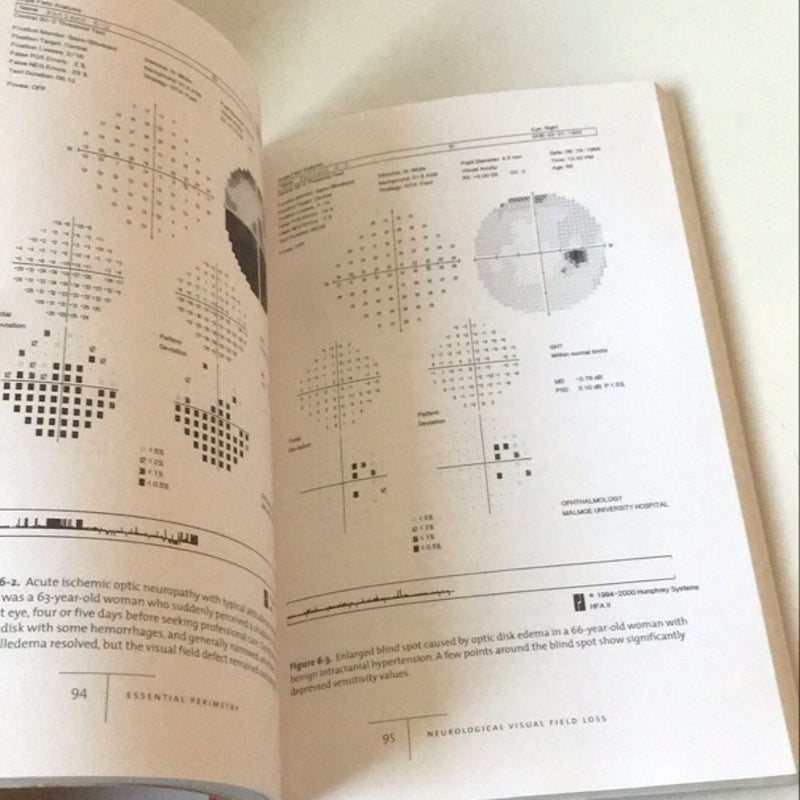 Essential Perimetry, 3rd Edition 