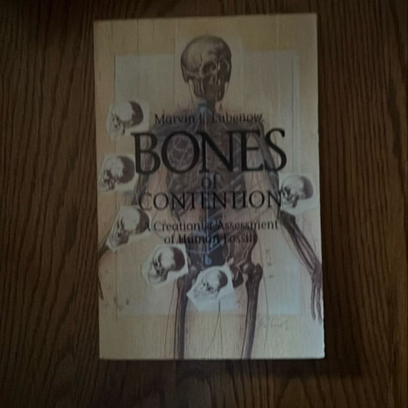 Bones of Contention