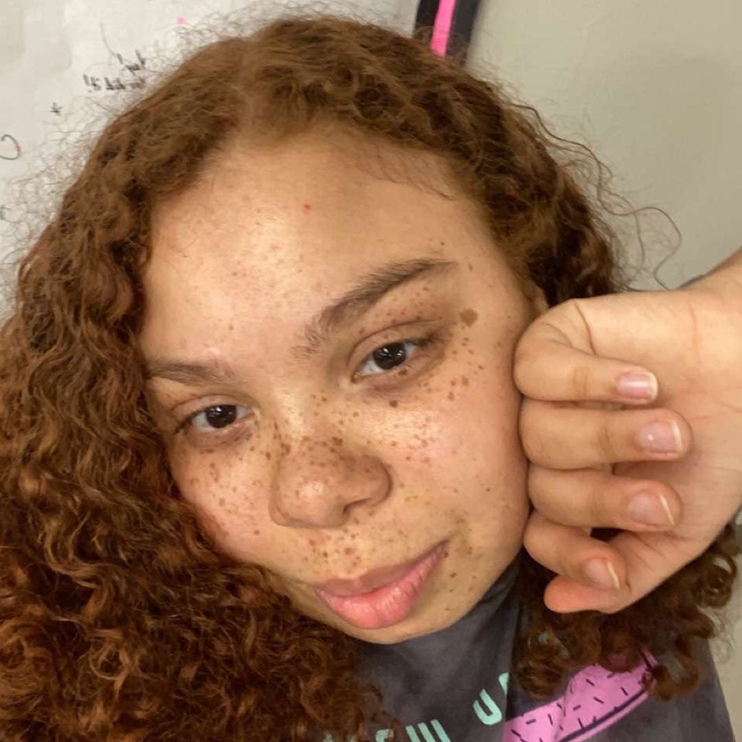 Kyla