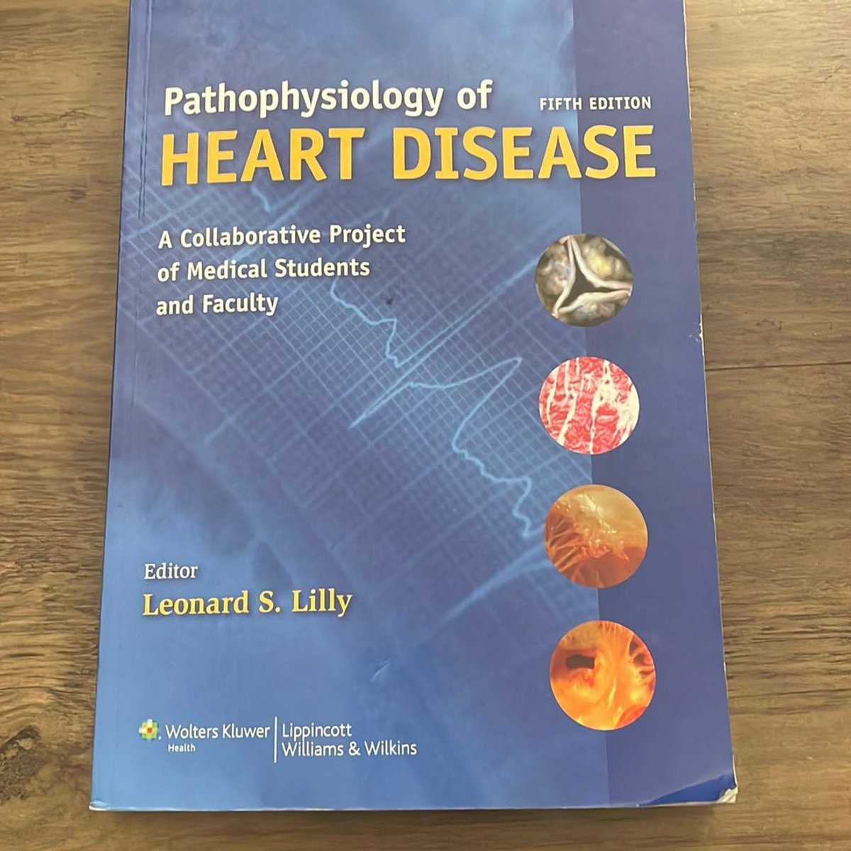 Pathophysiology of Heart Disease by Leonard S. Lilly
