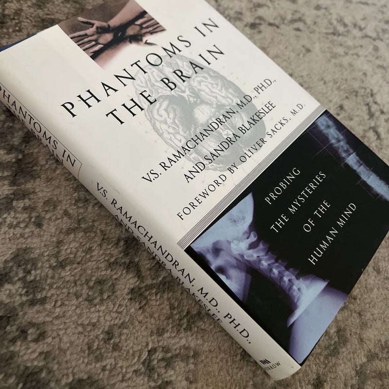 Phantoms in the Brain