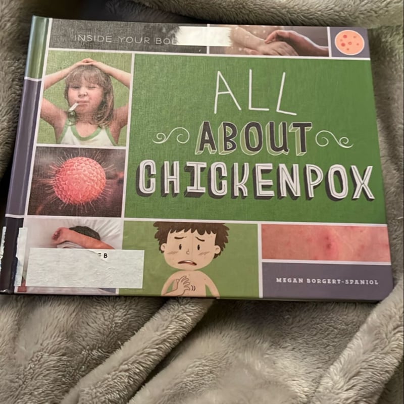 All about Chickenpox by Megan Borgert-Spaniol