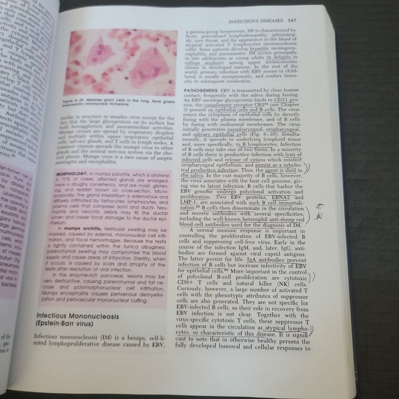 Robbins Pathologic Basis of Disease