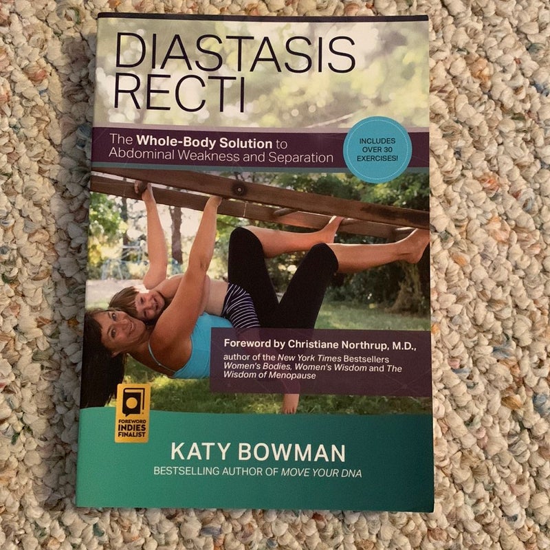 Diastasis Recti