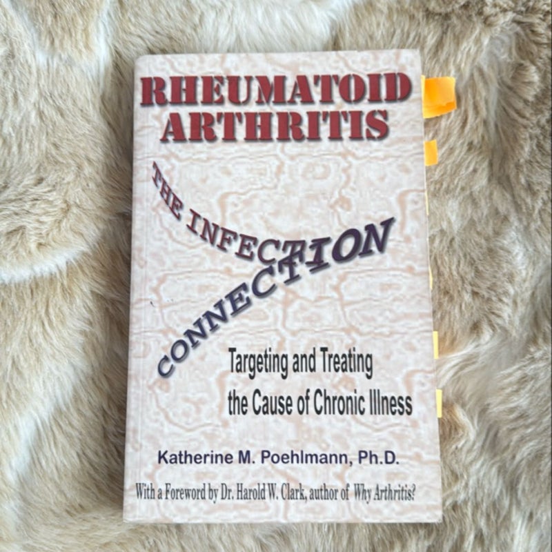 Rheumatoid Arthritis