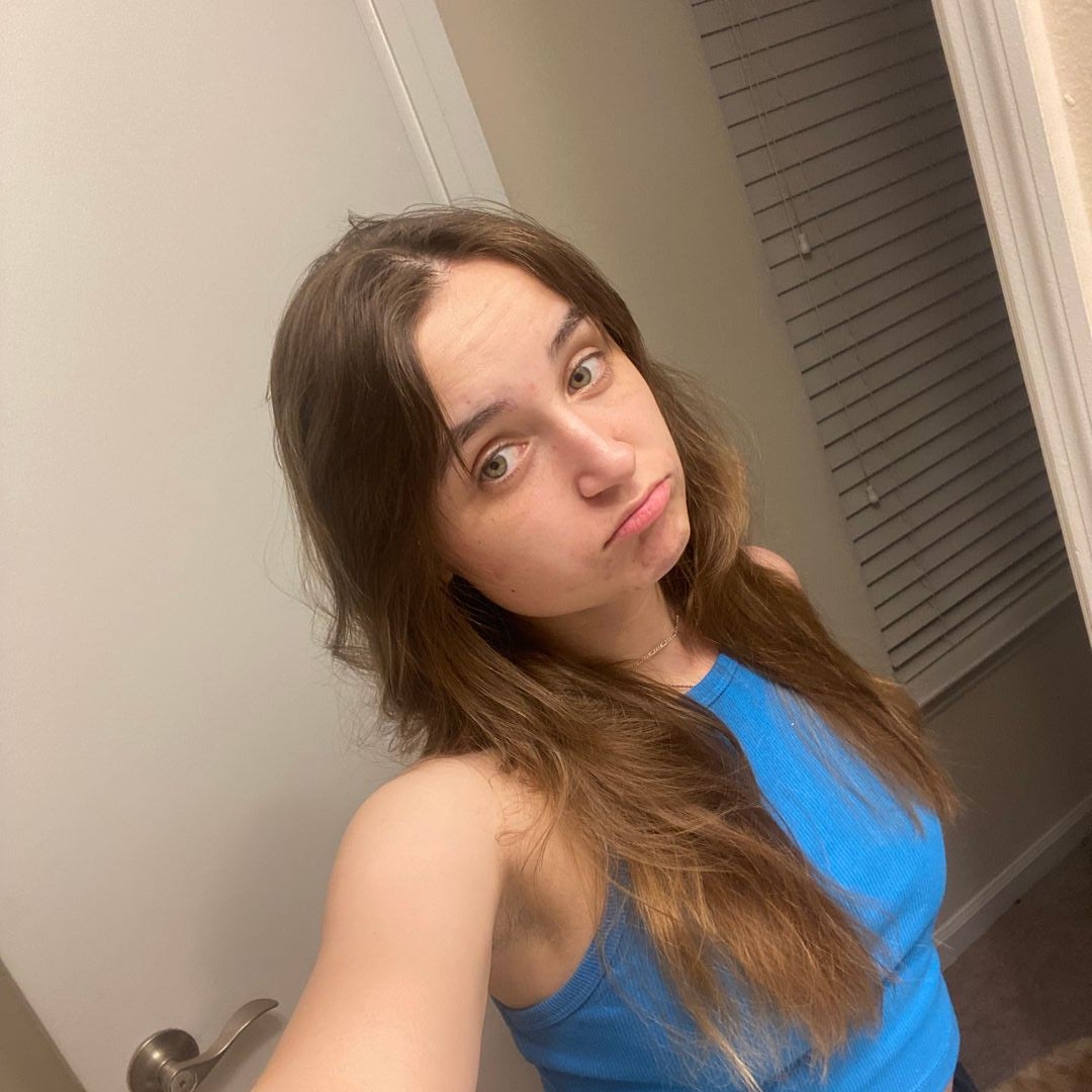 allie