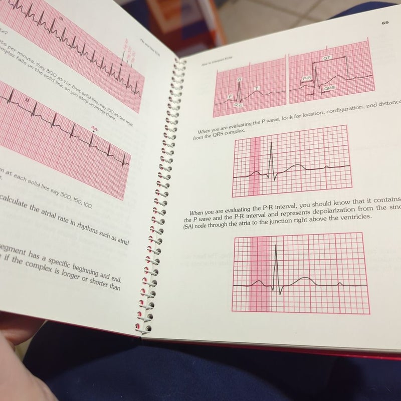 Flip and See ECG