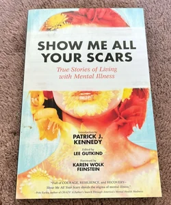 Show Me All Your Scars