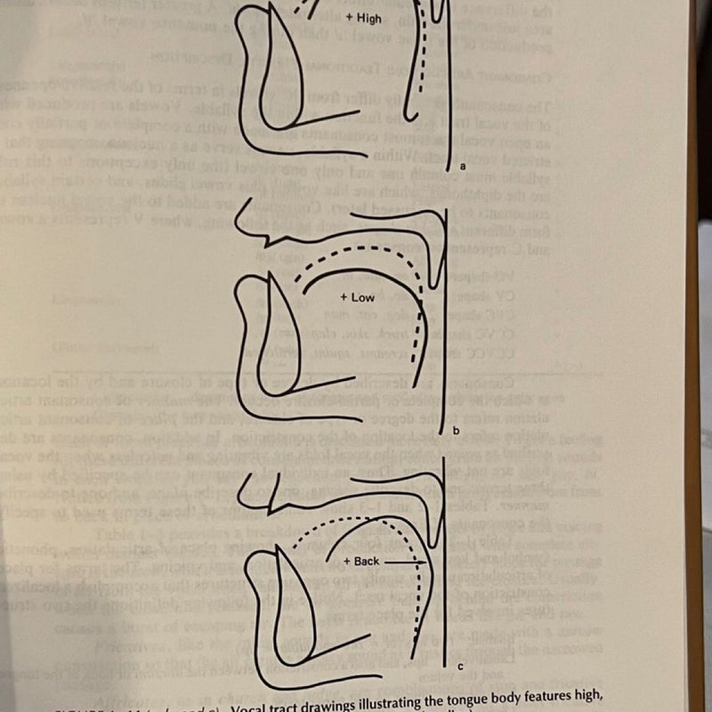 Articulation and Phonological Disorders