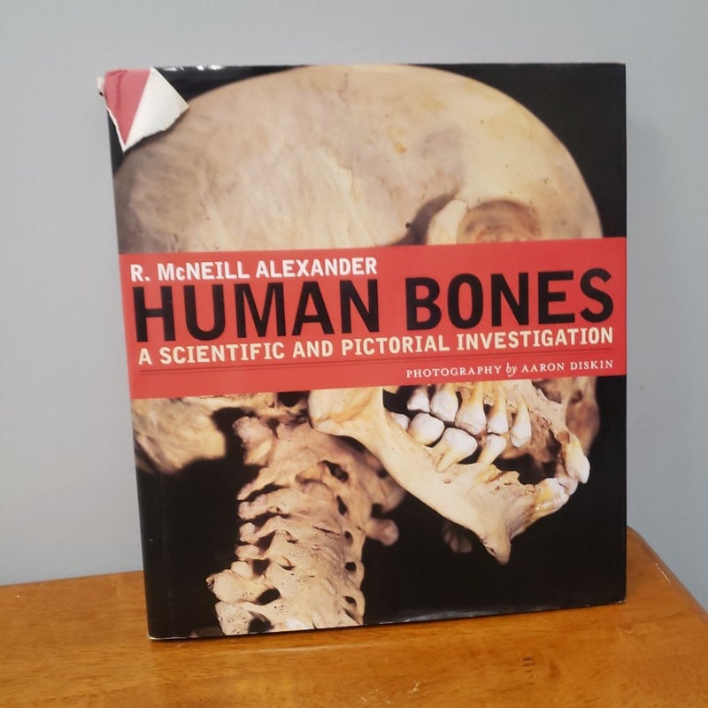 Human Bones