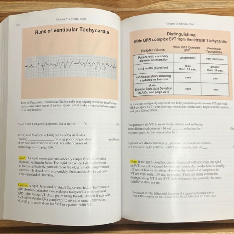 Rapid Interpretation of EKG's