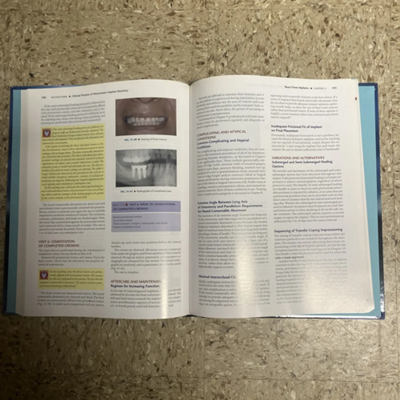 Principles and Practice of Implant Dentistry Weiss DDS