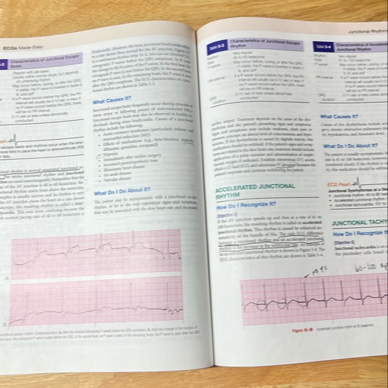 ECGs Made Easy