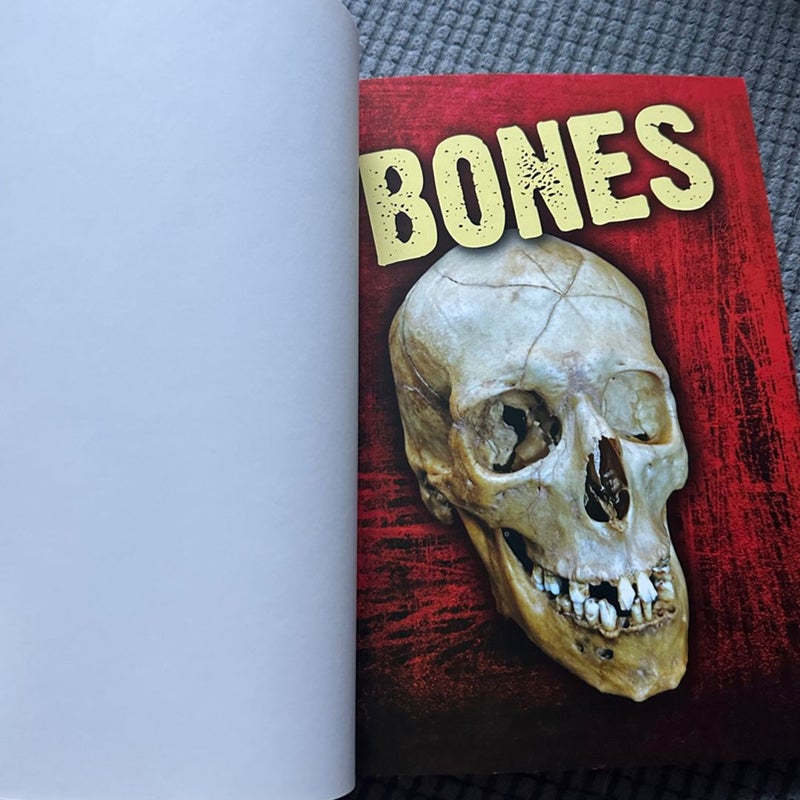 Bones