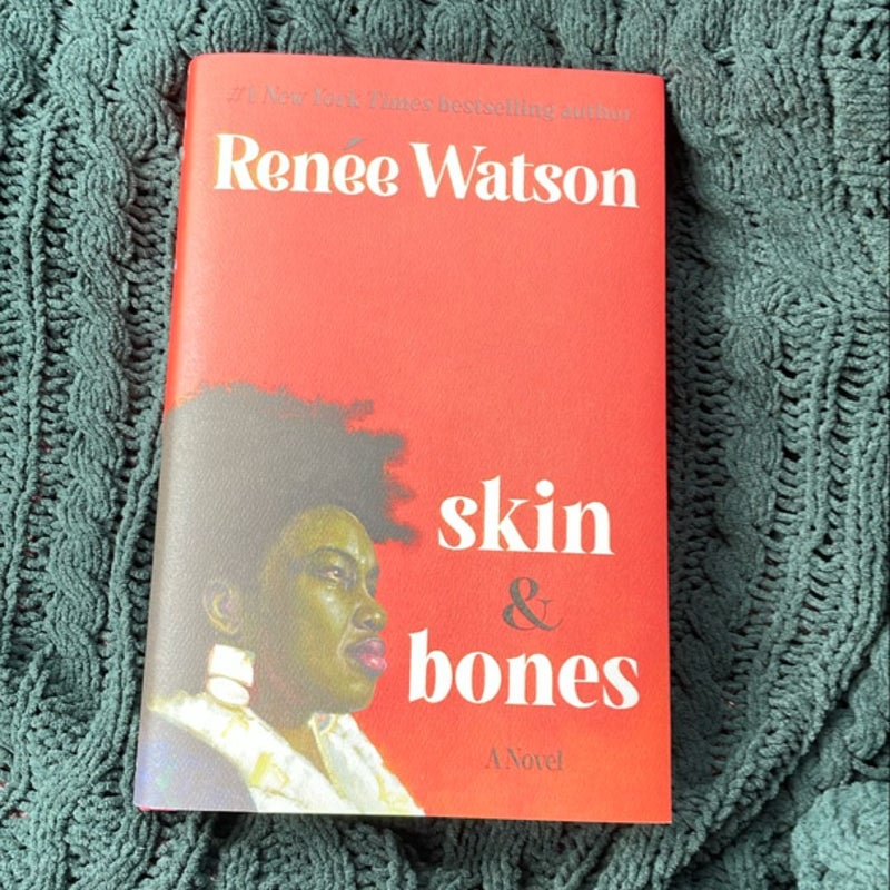 Skin and Bones