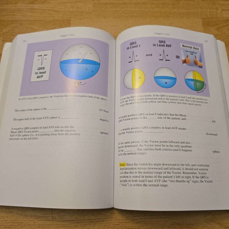 Rapid Interpretation of EKG's 6th edition
