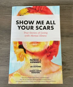 Show Me All Your Scars