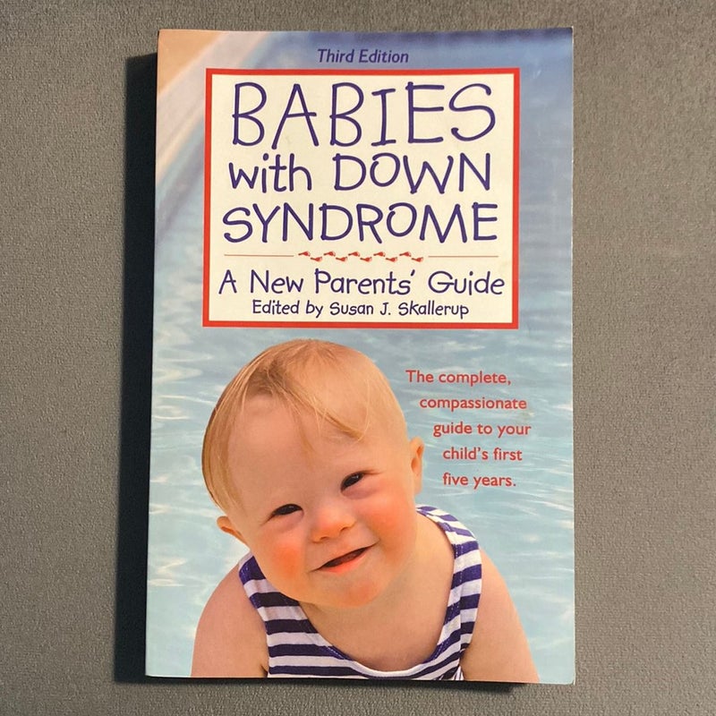 Babies with down Syndrome