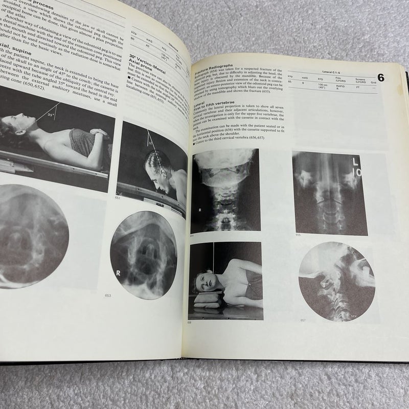 Clark’s Positioning in Radiography 