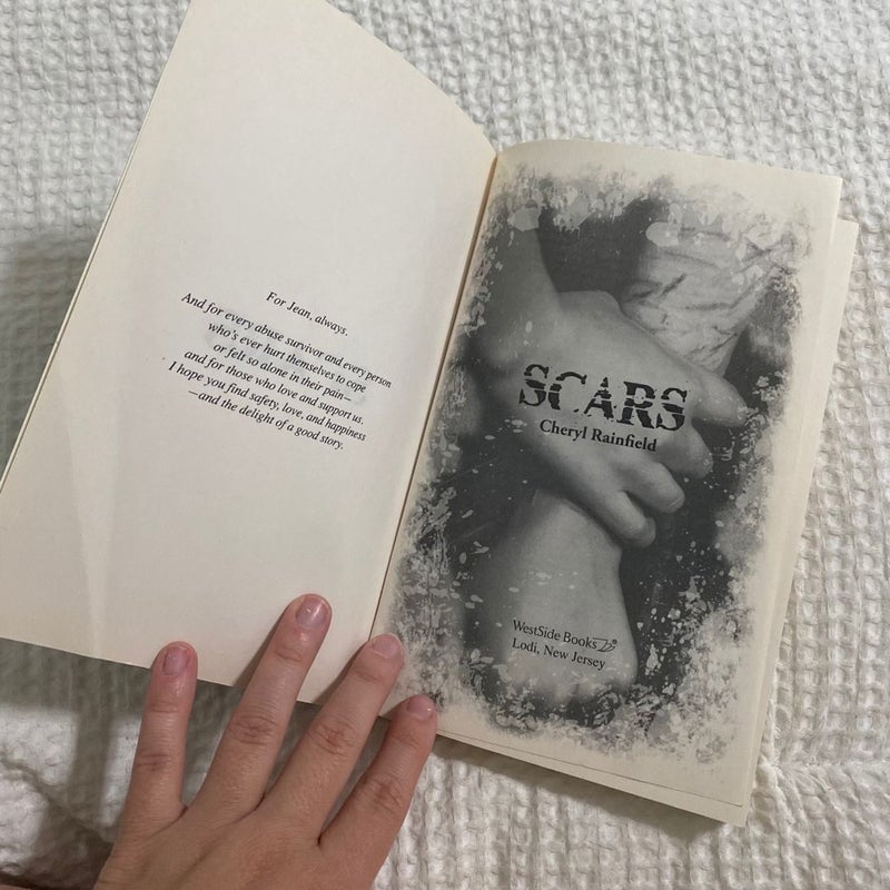 Scars