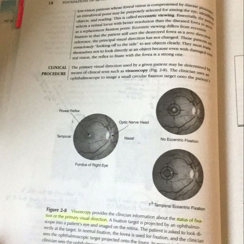 Foundations of Binocular Vision: a Clinical Perspective