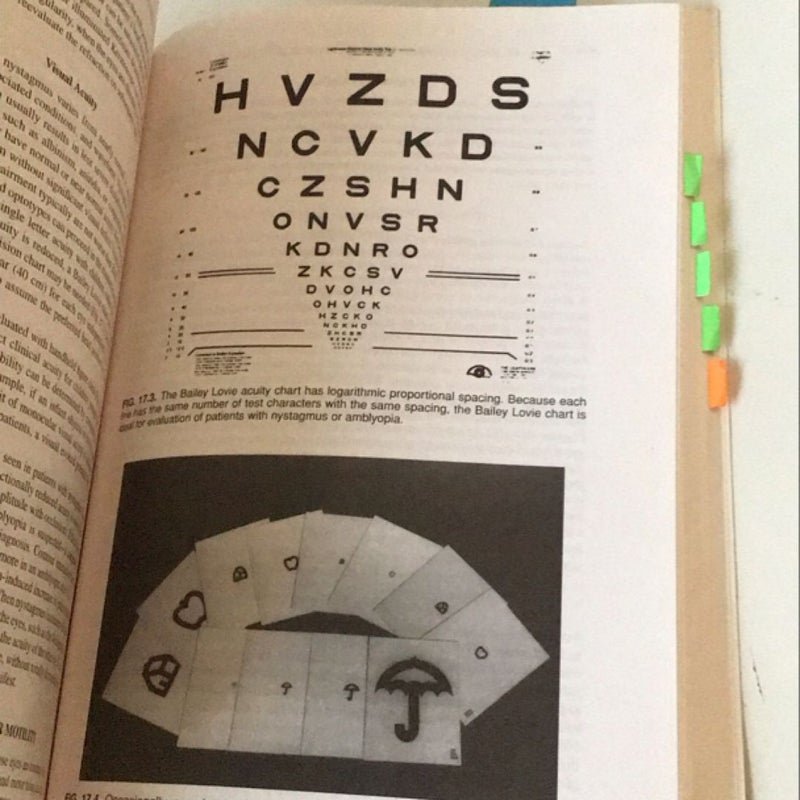 Clinical Management of Binocular Vision