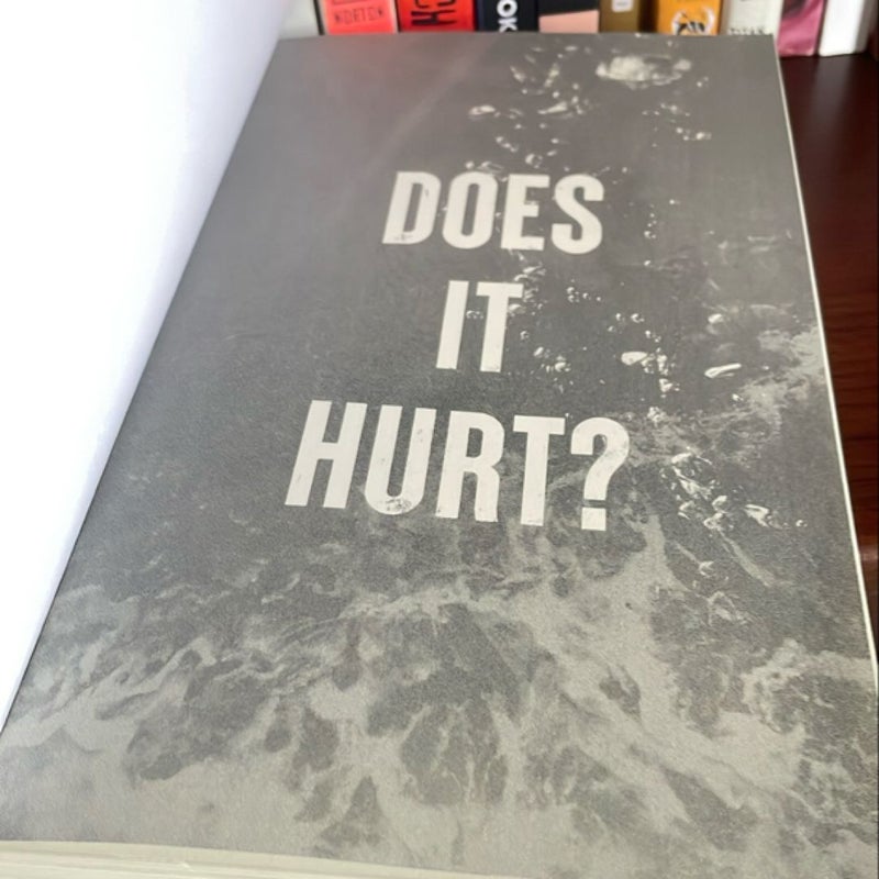 Does It Hurt?