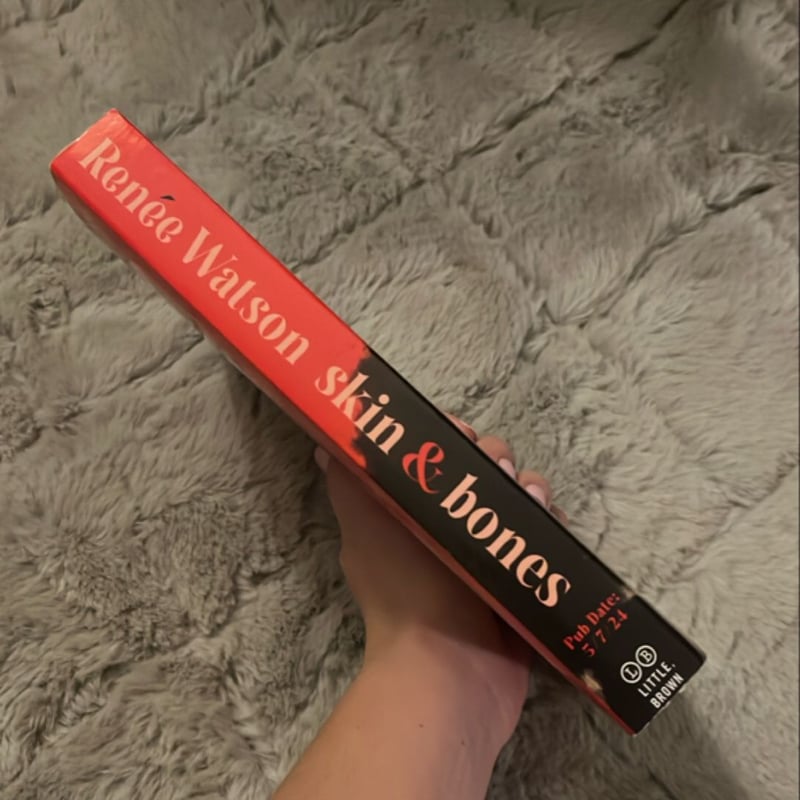 Skin and Bones