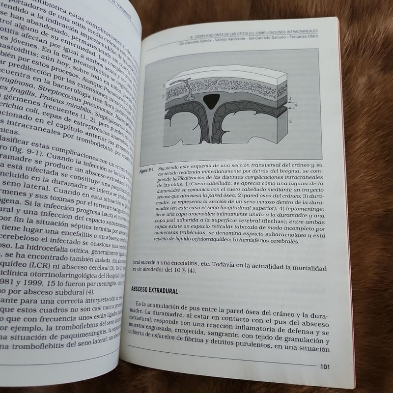 Otologia: enfermedades inflamatorias e hipoacusias de transmisión 