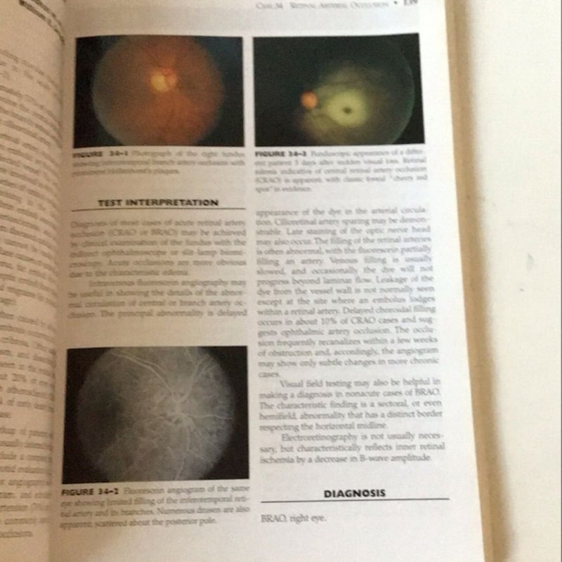 Ophthalmology Review