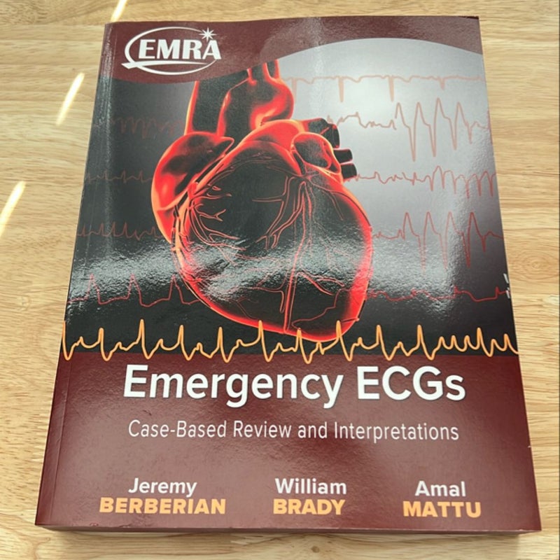 Emergency ECGs - Print