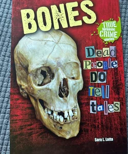 Bones