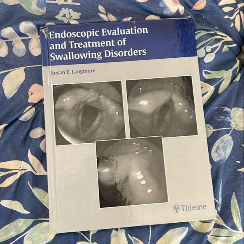 Endoscopic Evaluation and Treatment of Swallowing Disorders