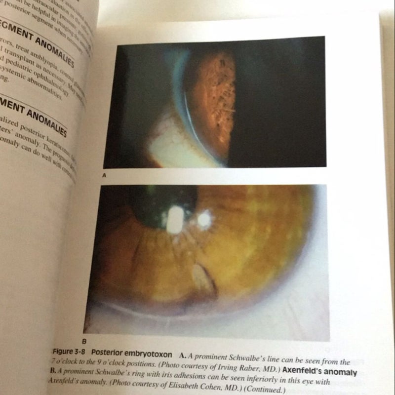 Cornea: Color Atlas and Synopsis of Clinical Ophthalmology (Wills Eye Hospital Series)