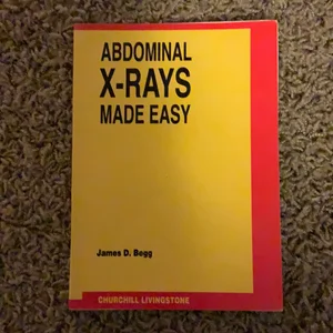 Chest X-Ray Made Easy