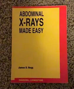 Chest X-Ray Made Easy