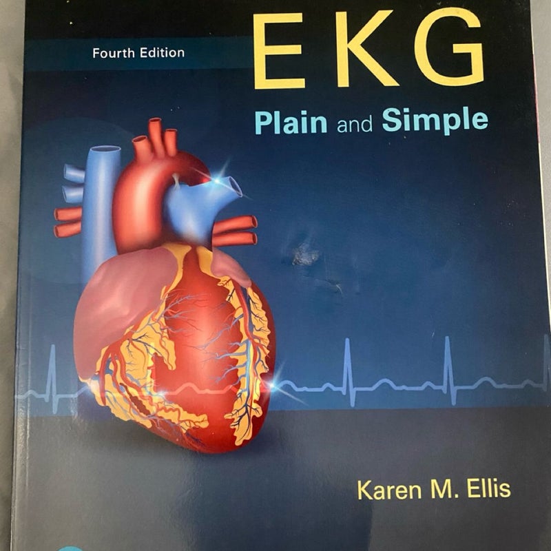 EKG Plain and Simple
