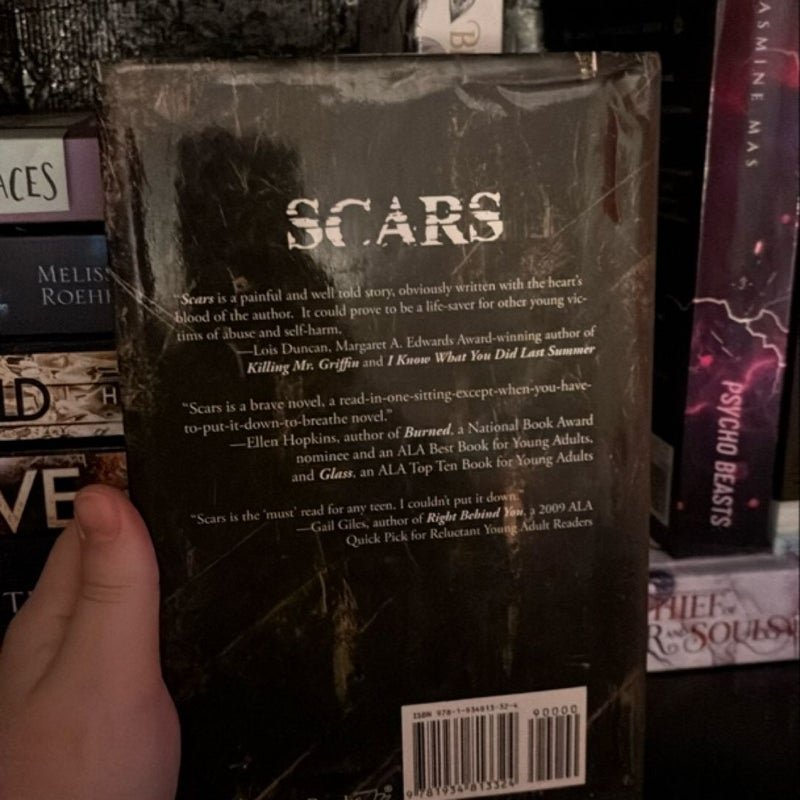 Scars